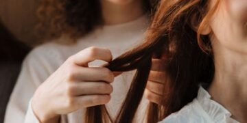 Native Shampoo Causing Dandruff
