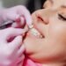 Snow Teeth Whitening Lawsuit